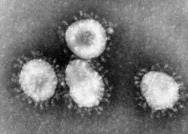 Coronaviruses are a group of viruses that have a halo, or crown-like (corona) appearance when viewed under an electron microscope.