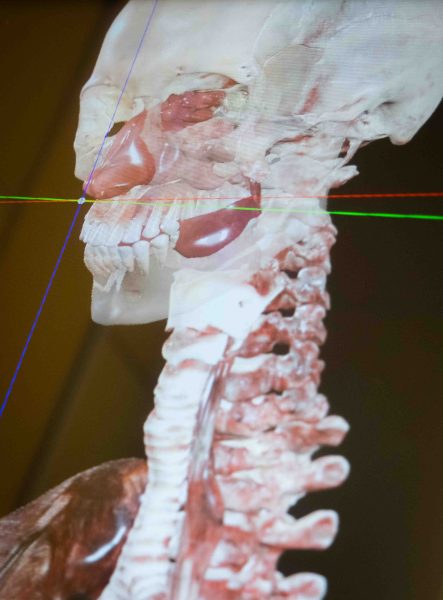 A close-up of the anatomage table shows a digital rendering of a skeleton featuring the skull and spine.